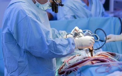 What Is Quintuple Bypass Surgery_